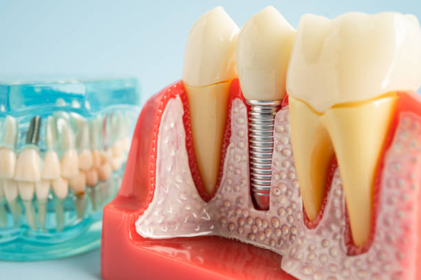 Best Cosmetic Dentistry  in Pittsburg, KS